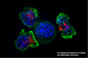 T_cells_surrounding_a_cancer_cell