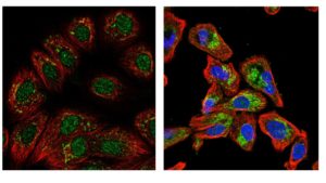 DHFR_DODH_cellular_localization