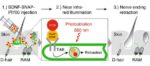 BDNF_targeted_photoablation_therapy